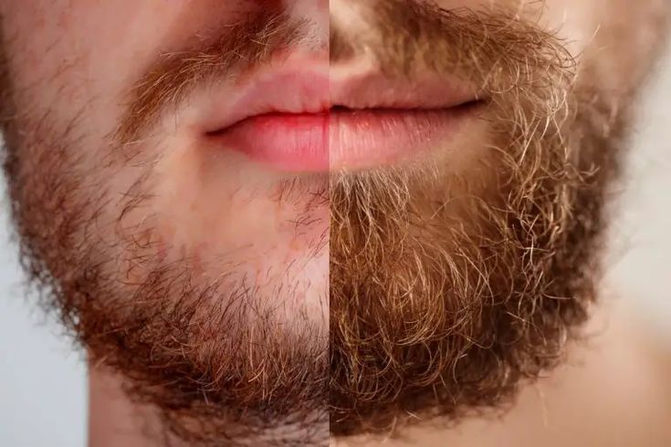 Grooming a Patchy Beard